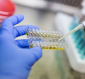 Image showing a laboratory fertility test.Close up image of a pair of blue gloved hands with the left holding a chambered slide and the right a pipette adding liquid to the chambers.