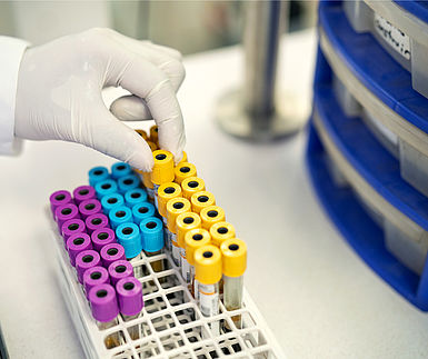 A lab technician picking a test tube out from a rack