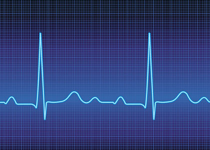 Image of heart beats on a ECG