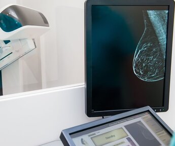Image showing digital mammography