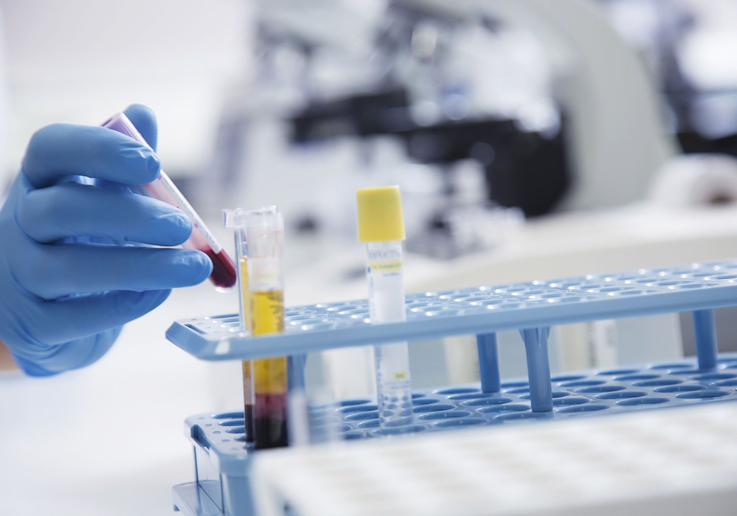 Image showing Blood samples being analysed in a hospital