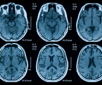 Image showing MRI scan of the brain