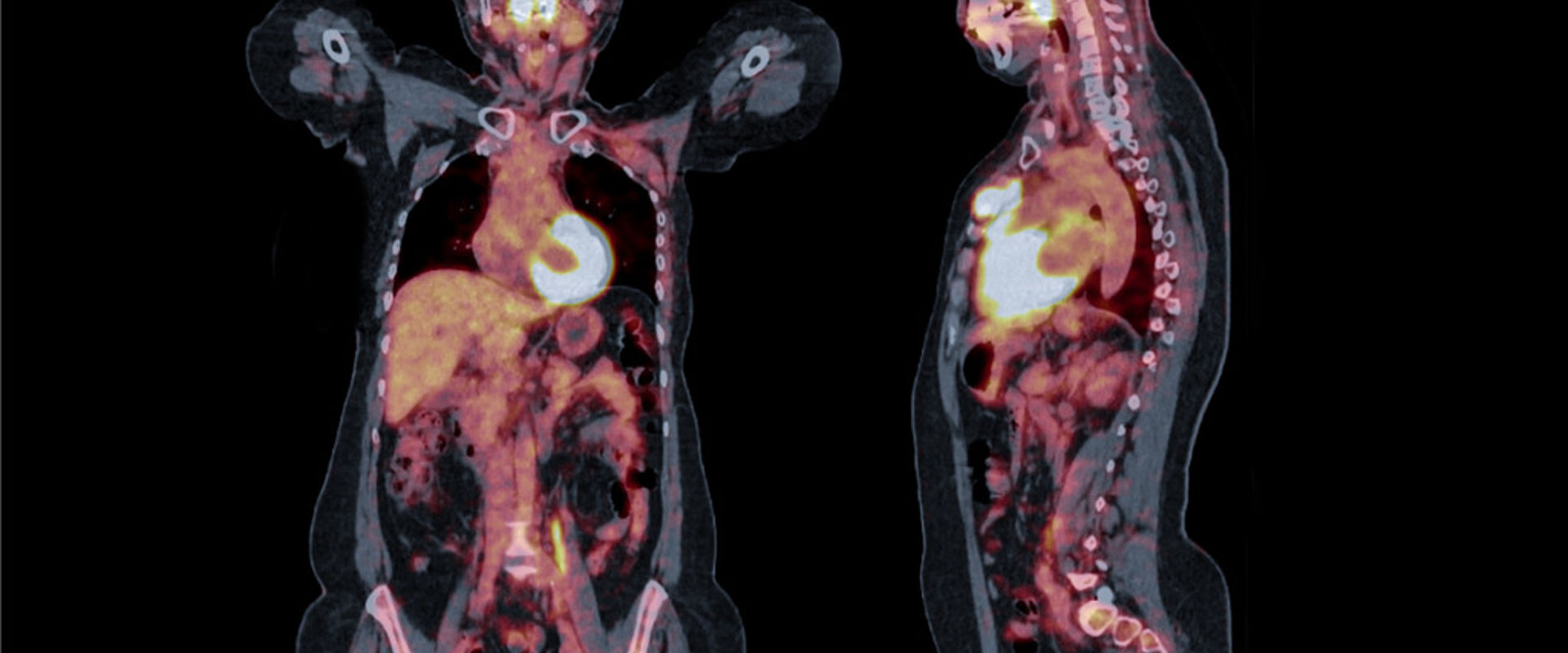 © Mr Suphachai Praserdumrongchai