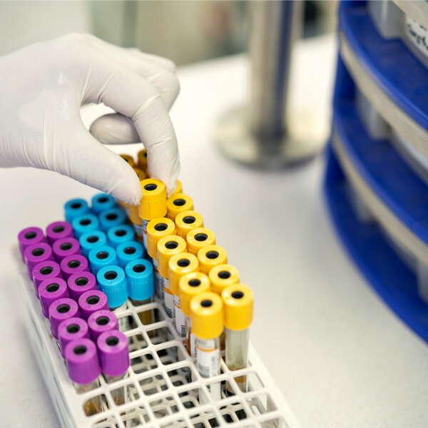 A lab technician picking a test tube out from a rack