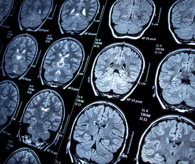 Image showing MRI scans of the brain