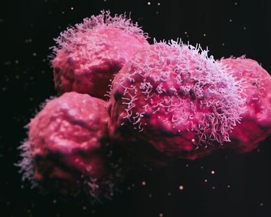 Close up of malignant cancer cells