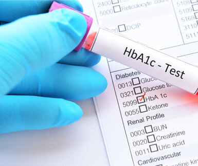 Image showing a blood sample for HbA1c test, diabetes diagnosis