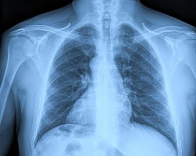 Image showing medical X-ray