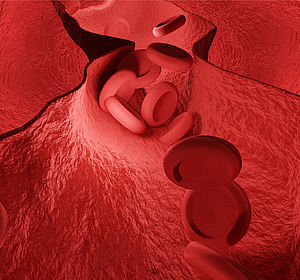 Image of red blood cells blocking an artery