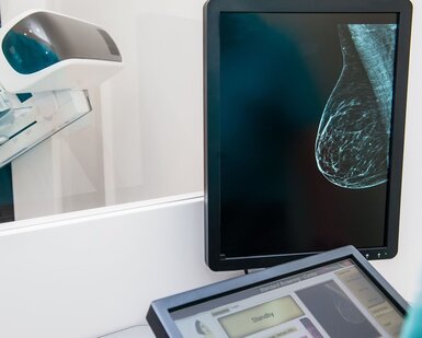 Image showing digital mammography