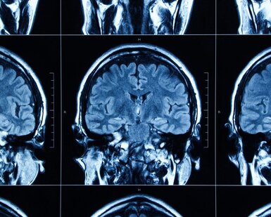 Image showing MRI scan of human head