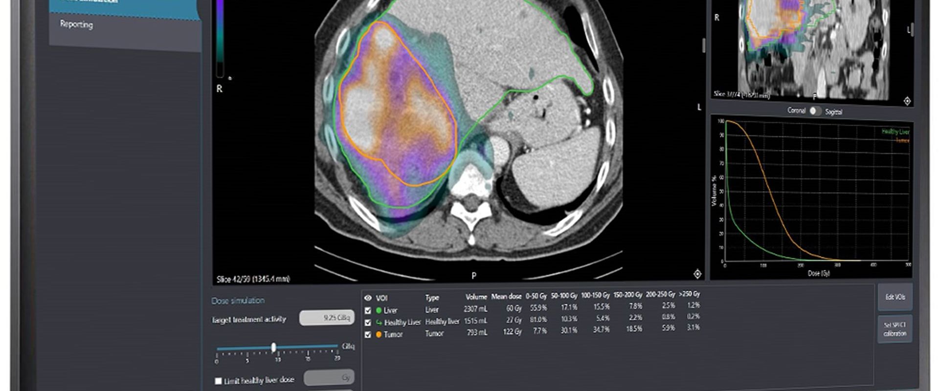 Courtesy of Quirem Medical