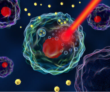 Image of a cancer cell undergoing hyperthermia treatment
