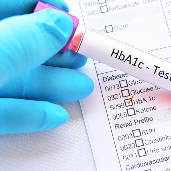 Image showing a blood sample for HbA1c test, diabetes diagnosis
