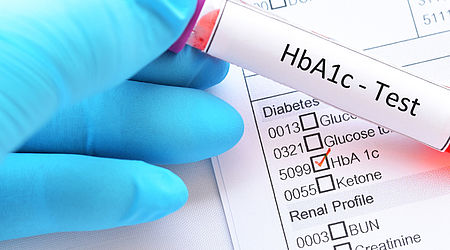 Image showing a blood sample for HbA1c test, diabetes diagnosis