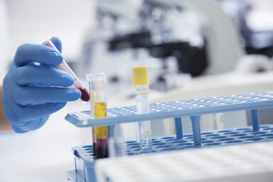 Image showing Blood samples being analysed in a hospital