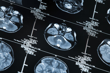 Image showing a MRI scan of a human head