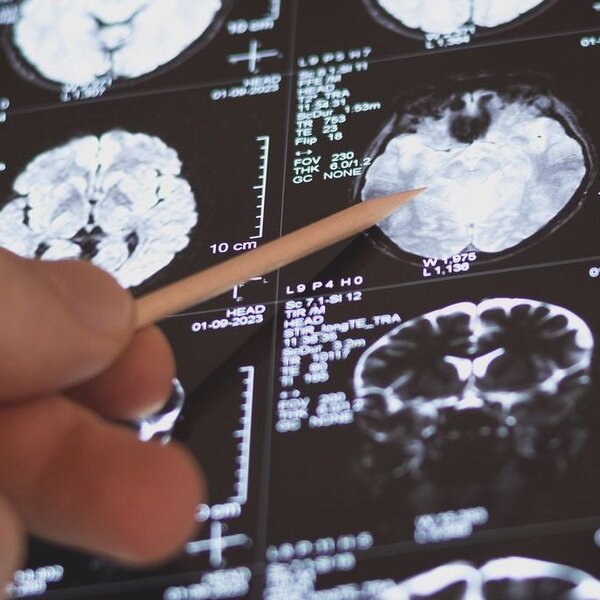 Image showing medical scan of human brain