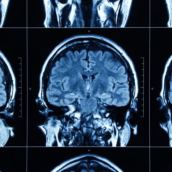 Image showing MRI scan of human head
