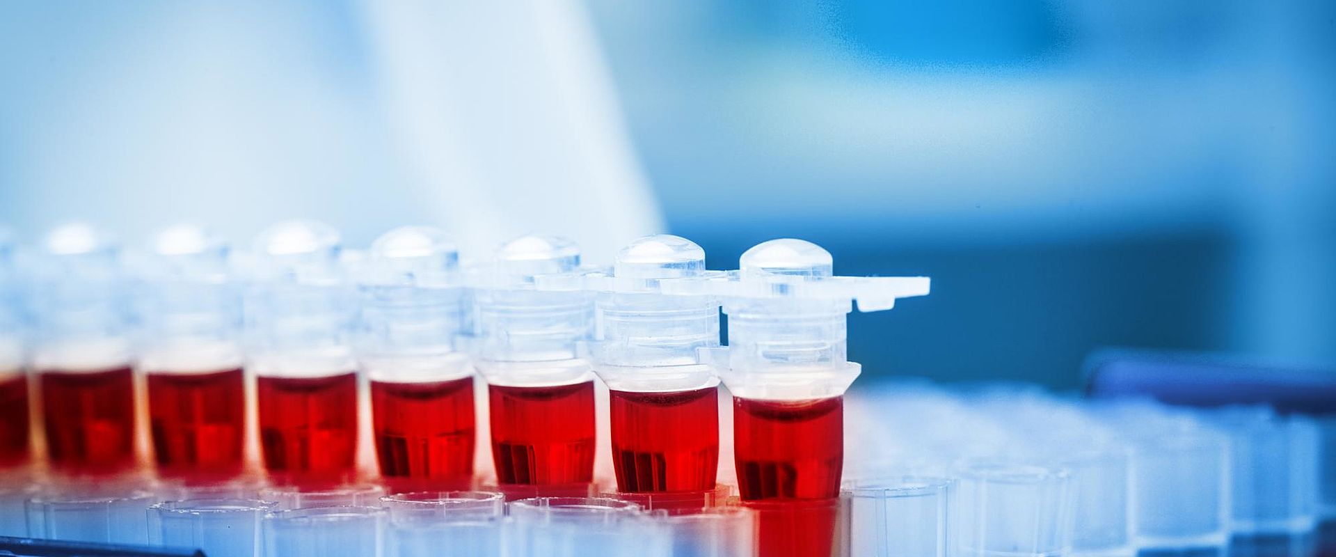 HLT02 iStock 177258068 Close up of collection of blood samples in the lab web