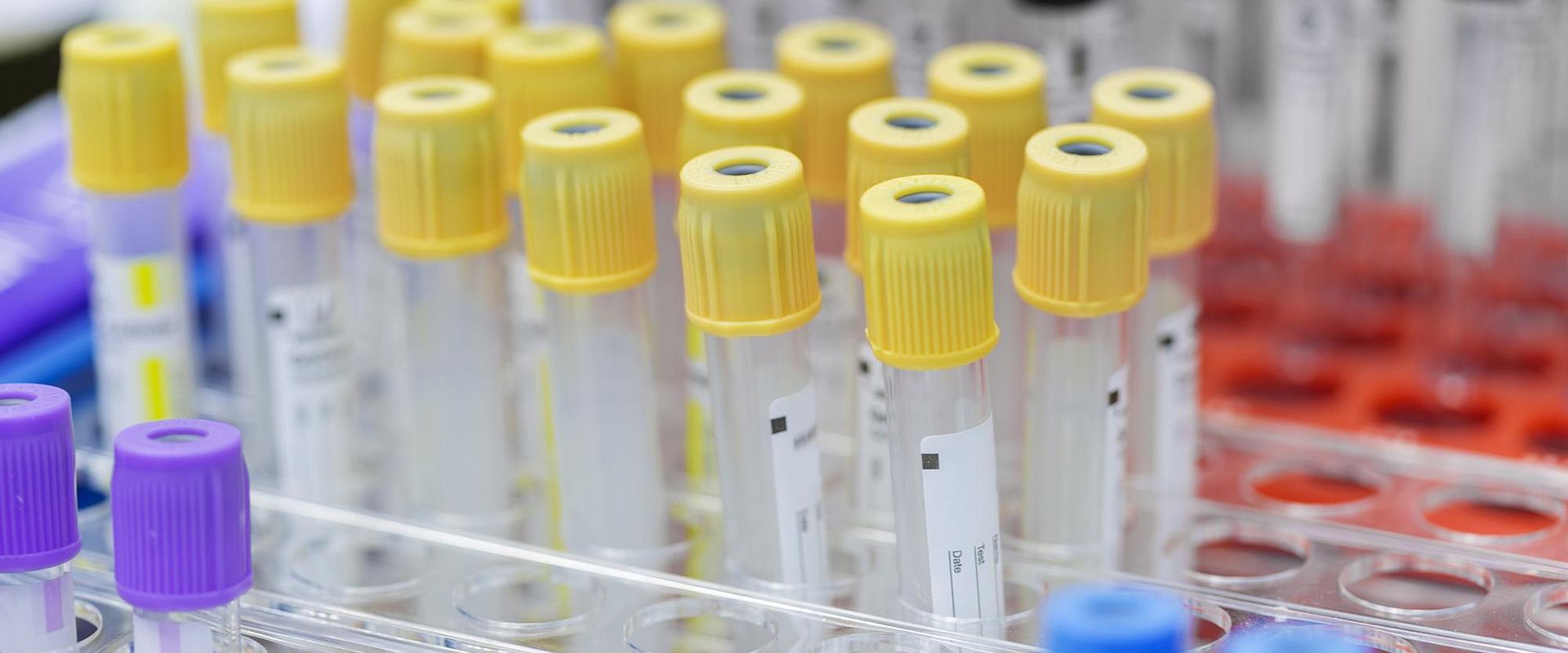 HLT02 iStock 585778250 LaboratoryEmpty Vacutainers web