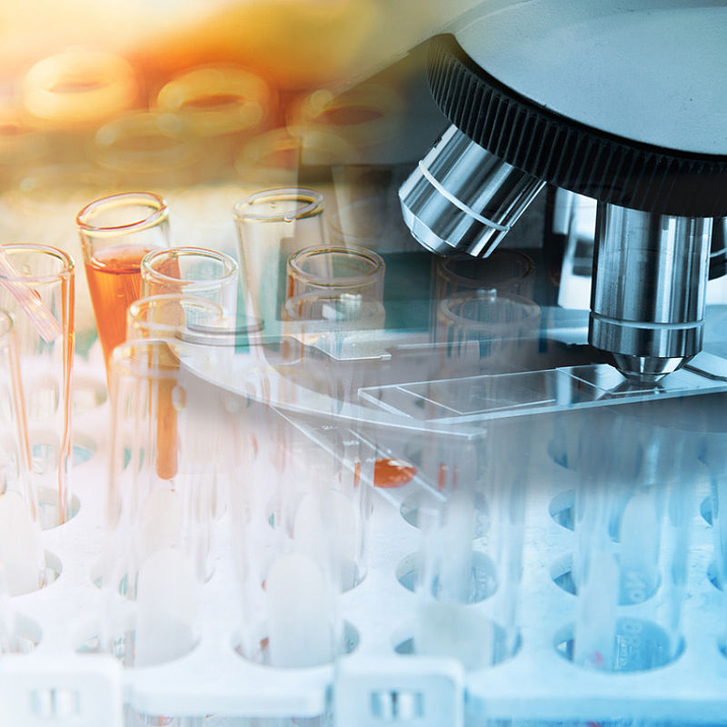 Standardising extracellular vesicle measurements for medical diagnosis Image of microscope and laboratory glasware