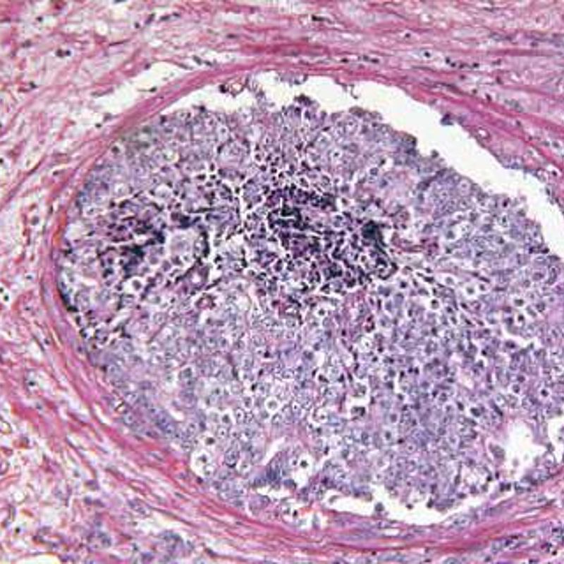 Metrology for molecular radiotherapy
