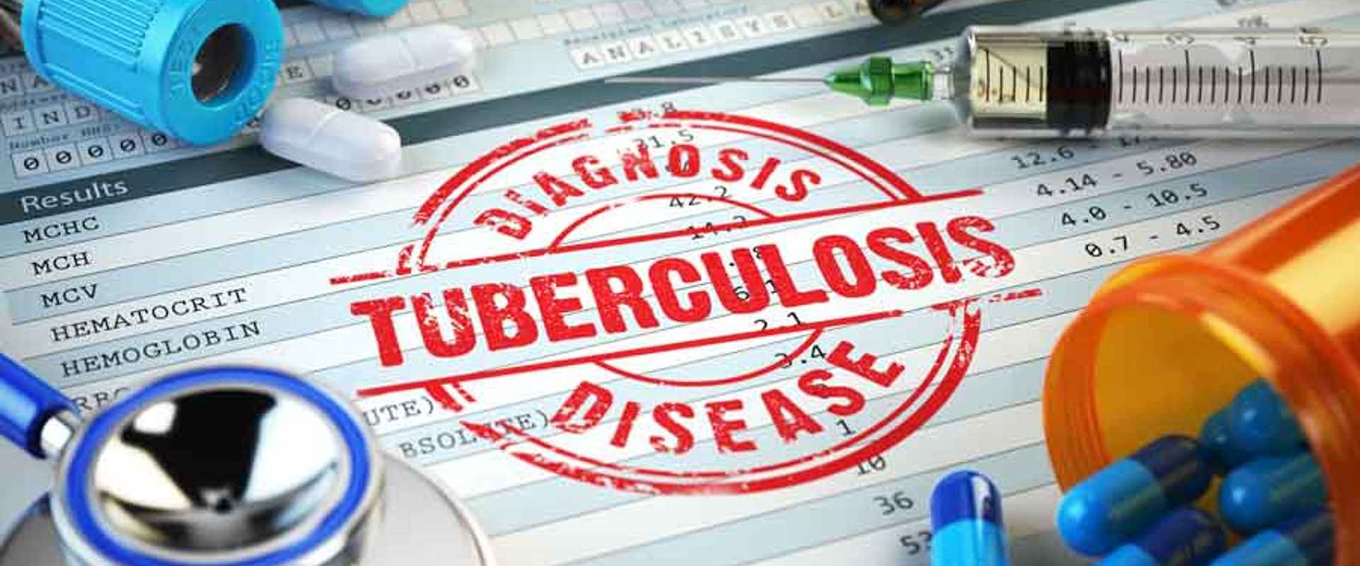 HLT08 IStock 586205074 Tuberculosis diagnosis