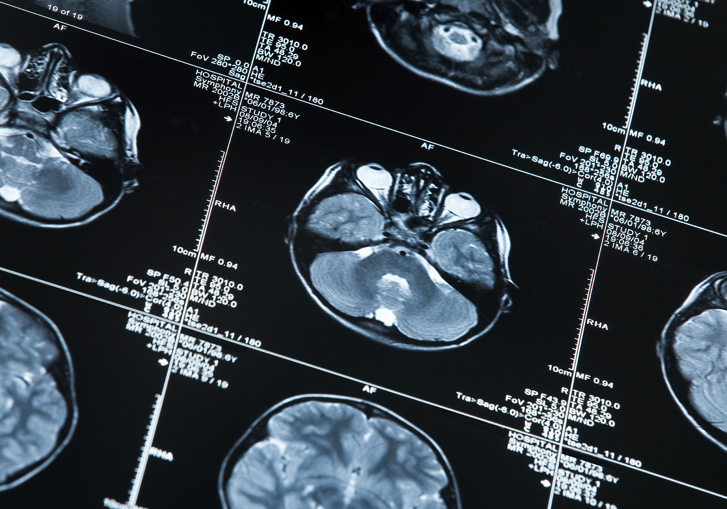 Image showing a MRI scan of a human head