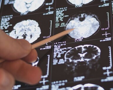 Image showing medical scan of human brain