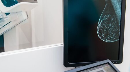Image showing digital mammography