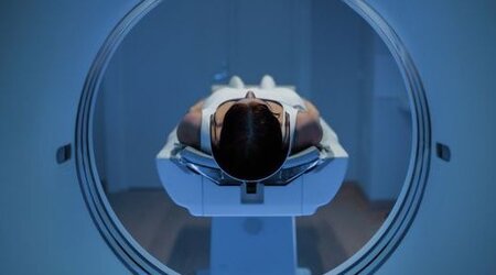 Image showing female patient lying on MRI scan bed 
